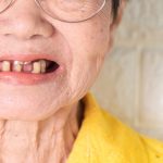 Soulagez vos gencives douloureuses avec des remèdes de grand-mère : des astuces naturelles qui marchent !