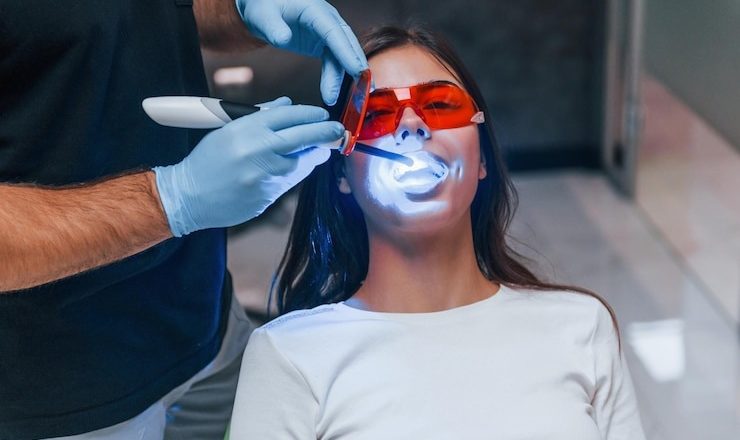 Comment obtenir un sourire éclatant avec le blanchiment dentiste : tout ce que vous devez savoir