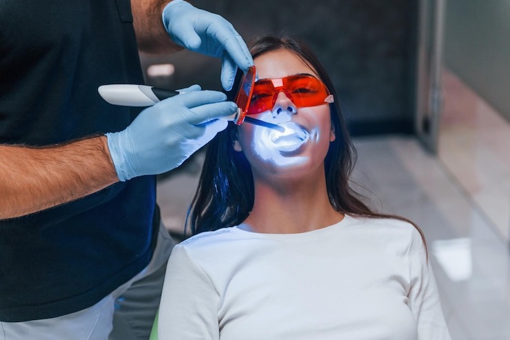 Comment obtenir un sourire éclatant avec le blanchiment dentiste : tout ce que vous devez savoir