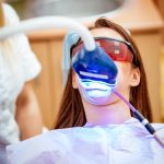 Amazon Blanchiment Dentaire : Guide Complet pour un Sourire Éclatant