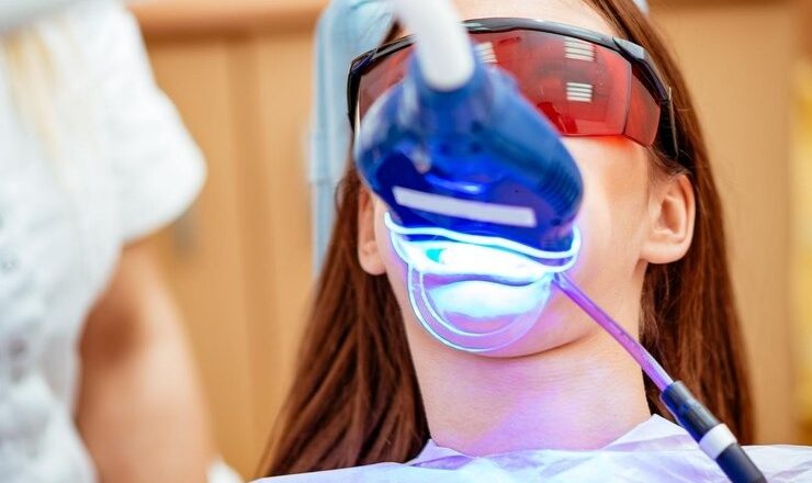 T’as envie d’un sourire qui claque ? Tout ce que t’as besoin de savoir sur le dentiste blanchiment des dents !