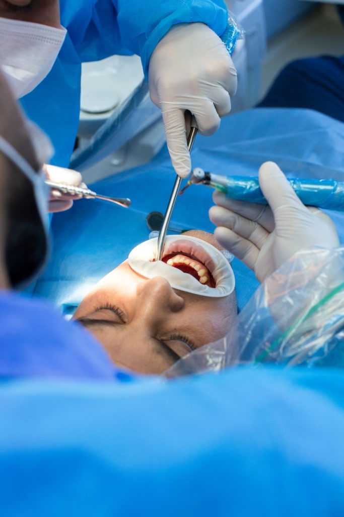 Comment soigner une rage de dent sans perdre la tête