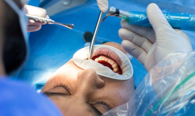 Comment soigner une rage de dent sans perdre la tête