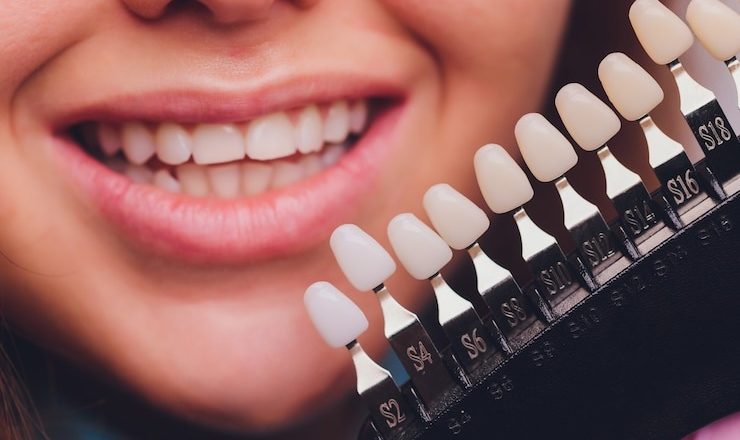 Comment transformer votre sourire avec la zircone dentaire : tout ce que vous devez savoir