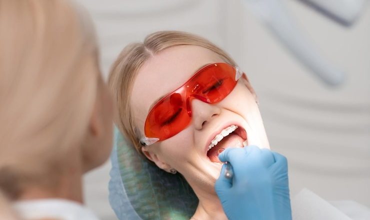 Détartrage des dents : Tout ce que vous devez savoir pour un sourire éclatant