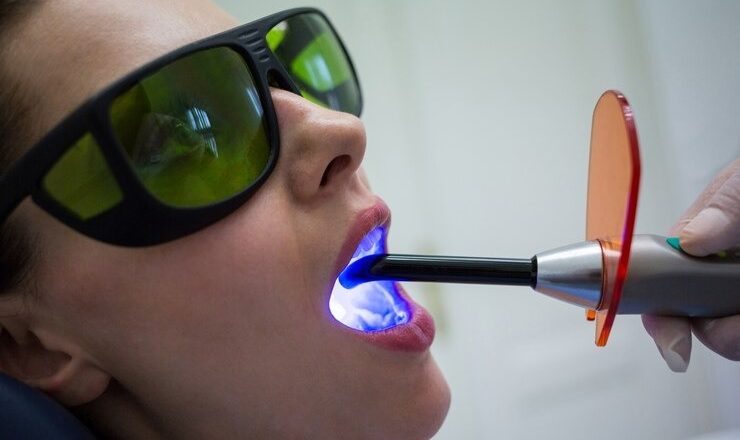 T’as envie d’un sourire éblouissant avec le blanchiment dentaire laser ?