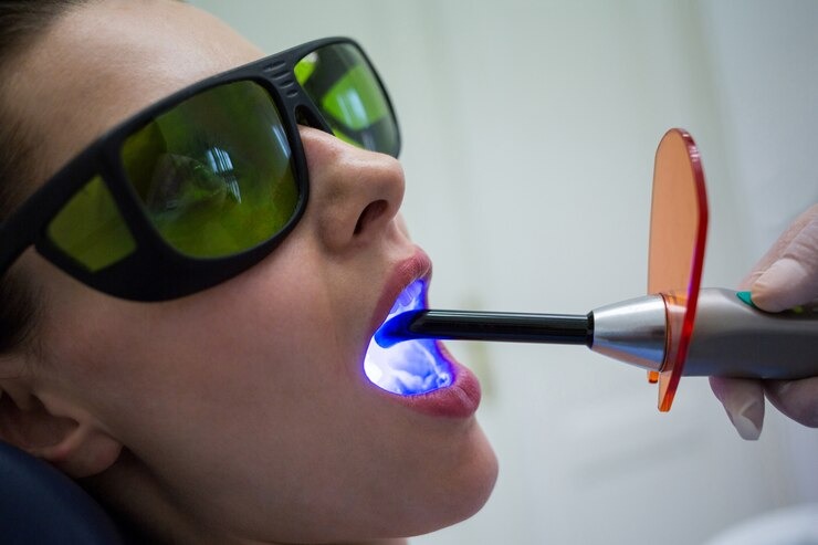 T’as envie d’un sourire éblouissant avec le blanchiment dentaire laser ?