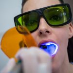 Blanchiment dentaire pharmacie : tout ce que vous devez savoir pour un sourire éclatant