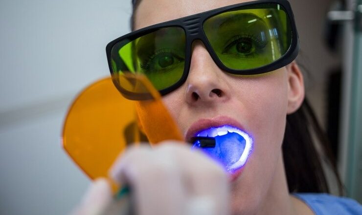 Blanchiment dentaire pharmacie : tout ce que vous devez savoir pour un sourire éclatant