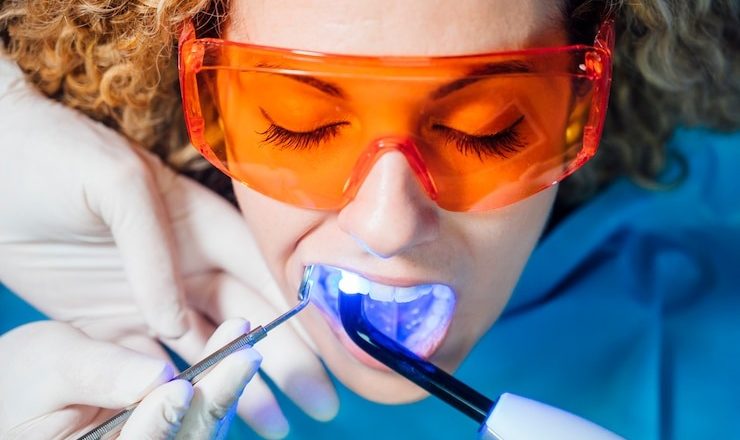 Blanchiment dentaire en Suisse : Combien ça coûte et comment obtenir un sourire éclatant ?