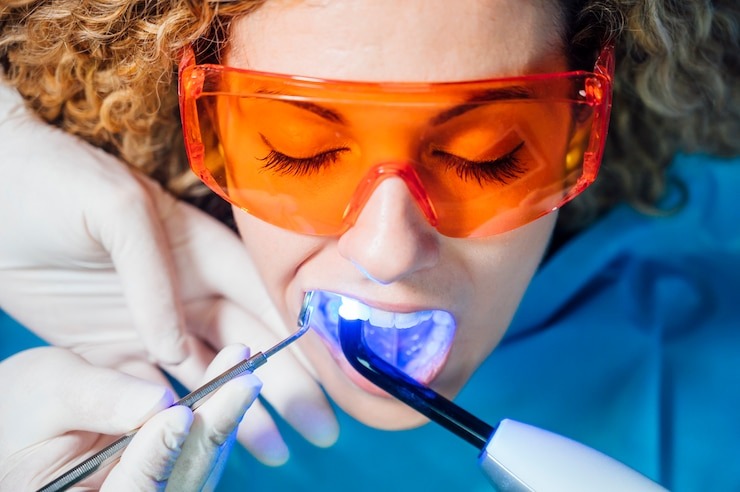 Blanchiment dentaire en Suisse : Combien ça coûte et comment obtenir un sourire éclatant ?