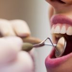 T’as déjà fait un détartrage ? Voici pourquoi c’est un game-changer pour tes dents !