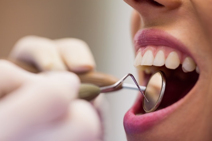 T’as déjà fait un détartrage ? Voici pourquoi c’est un game-changer pour tes dents !