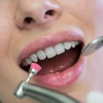 Blanchiment dentaire professionnel : Votre passeport pour un sourire éblouissant en 2025 !