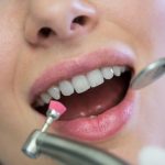 Guide ultime du traitement gencive : comment avoir des gencives en béton et un sourire qui déchire