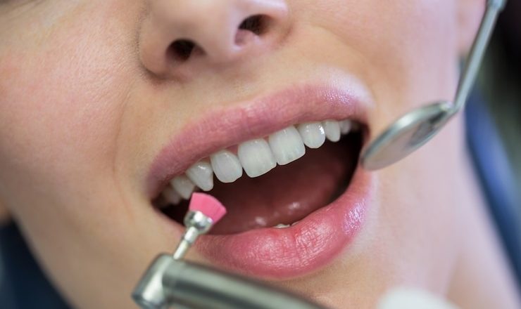 Guide ultime du traitement gencive : comment avoir des gencives en béton et un sourire qui déchire