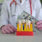 Tout ce que vous devez savoir sur le prix d’une dent sur pivot : Guide complet pour un sourire éclatant