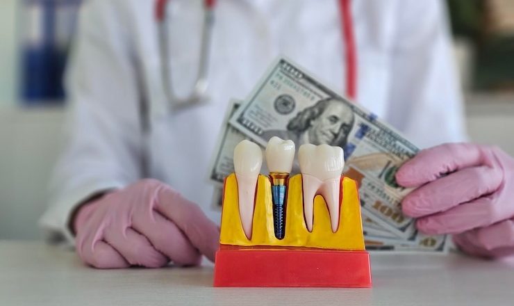 Tout ce que vous devez savoir sur le prix d’une dent sur pivot : Guide complet pour un sourire éclatant
