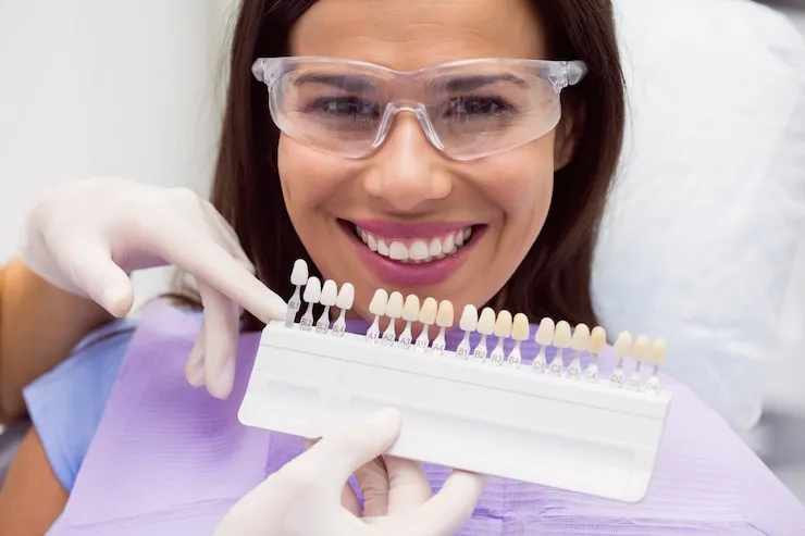 Blanchiment Dentaire Prix : Le gros guide 2025 pour des dents qui claquent