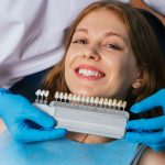 Tout ce que vous devez savoir sur le blanchiment des dents dentiste prix : Votre guide ultime pour un sourire éclatant