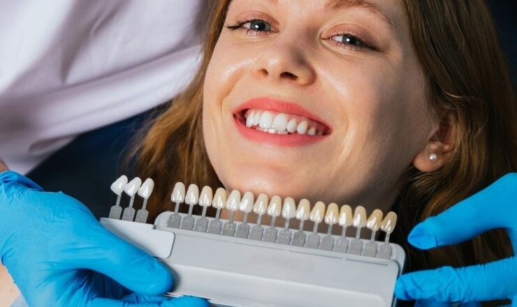 Tout ce que vous devez savoir sur le blanchiment des dents dentiste prix : Votre guide ultime pour un sourire éclatant