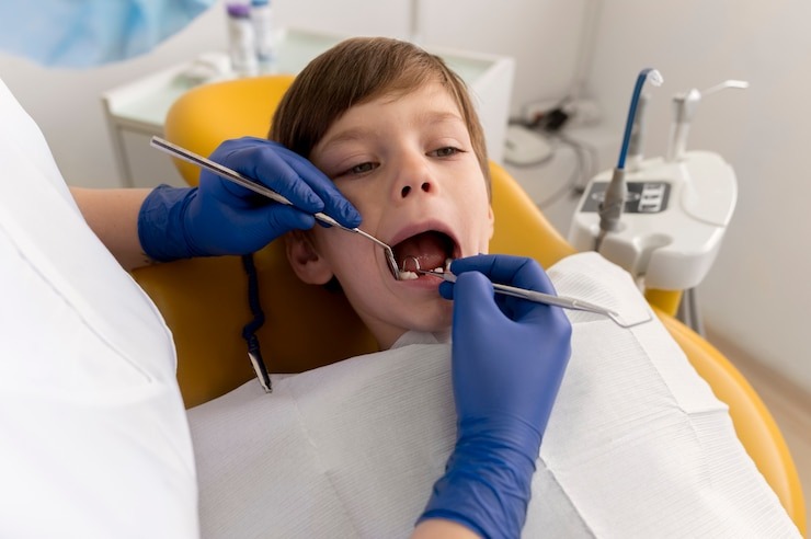 Comment soigner une carie sans dentiste : des astuces pour te dépanner en urgence