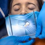 Tout ce que vous devez savoir sur l’amalgame dentaire : Votre guide pour des dents au top !