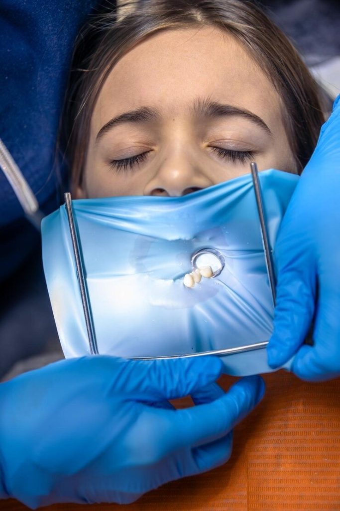 Tout ce que vous devez savoir sur l’amalgame dentaire : Votre guide pour des dents au top !