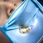 Tout ce que vous devez savoir sur le peroxyde d’hydrogène pour blanchir vos dents : Le guide ultime