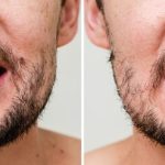 Tout ce que vous devez savoir sur les dents écartées : causes, solutions et astuces