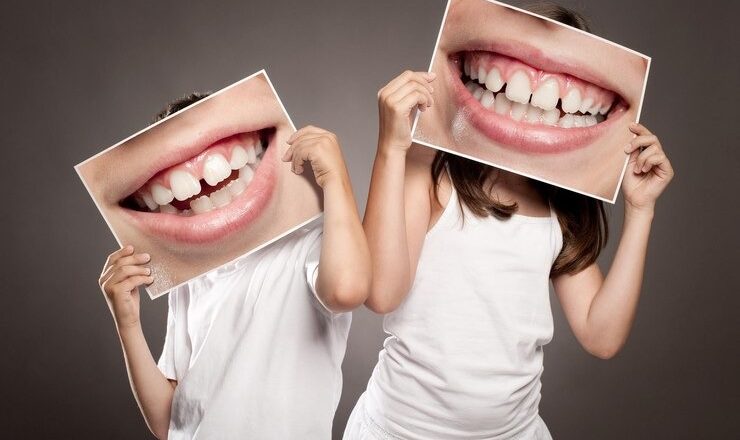 Dents du bonheur : Comment assumer votre sourire unique en Suisse ?