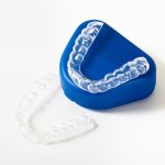 Tout ce que vous devez savoir sur le blanchiment dentaire avec gouttière : Un sourire éclatant à portée de main