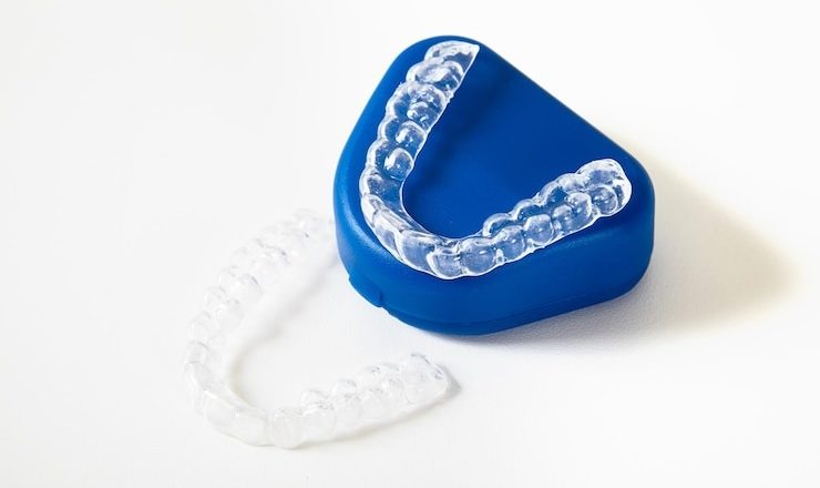 Tout ce que vous devez savoir sur le blanchiment dentaire avec gouttière : Un sourire éclatant à portée de main