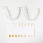 Tout ce que vous devez savoir sur le prix d’un bridge dentaire 6 dents en 2025 : Guide complet pour retrouver votre sourire