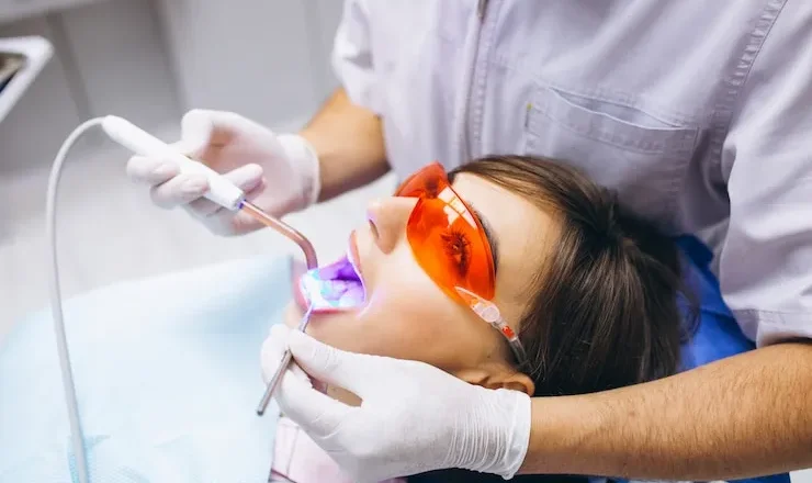Blanchiment des Dents : Le Guide Ultime Pour un Sourire Hollywoodien