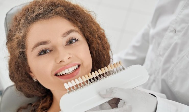 Comment obtenir un sourire éclatant grâce au traitement blanchiment des dents ?