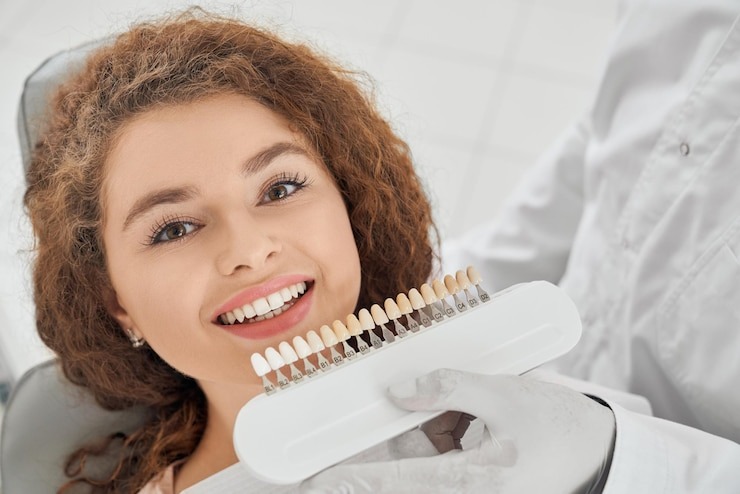 Comment obtenir un sourire éclatant grâce au traitement blanchiment des dents ?