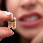 Tout ce que vous devez savoir sur une carie dentaire