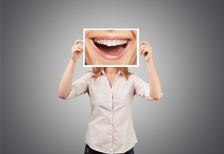 Le meilleur blanchiment dentaire : Comment obtenir un sourire éclatant qui fait tourner les têtes