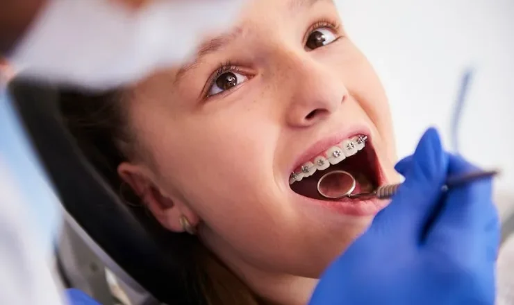 🦷 Mutuelle dentaire sans plafond : la solution ultime pour tes dents et ton portefeuille ?