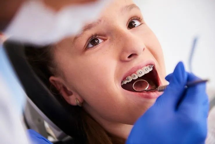 🦷 Mutuelle dentaire sans plafond : la solution ultime pour tes dents et ton portefeuille ?