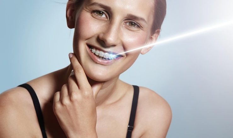 Guide Ultime sur le Blanchisseur de Dents : Prix, Techniques et Astuces pour un Sourire Éclatant