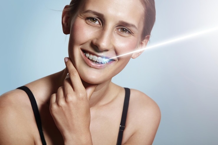 Guide Ultime sur le Blanchisseur de Dents : Prix, Techniques et Astuces pour un Sourire Éclatant