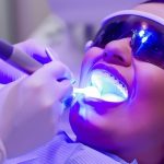 Comment obtenir un sourire éclatant grâce à une clinique blanchiment dentaire