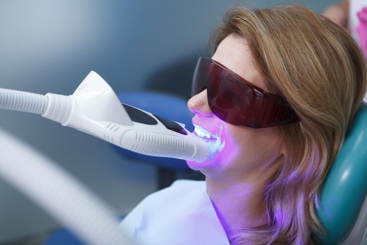 Comment obtenir un sourire éclatant grâce au blanchiment des dents