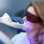Comment réussir votre éclaircissement dentaire pour un sourire qui claque