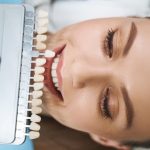 Comment transformer votre sourire avec e.max dentaire : le guide ultime pour un sourire éclatant