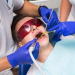 Tout ce que t’as besoin de savoir sur le détartrage dentaire : pour un sourire clean et healthy