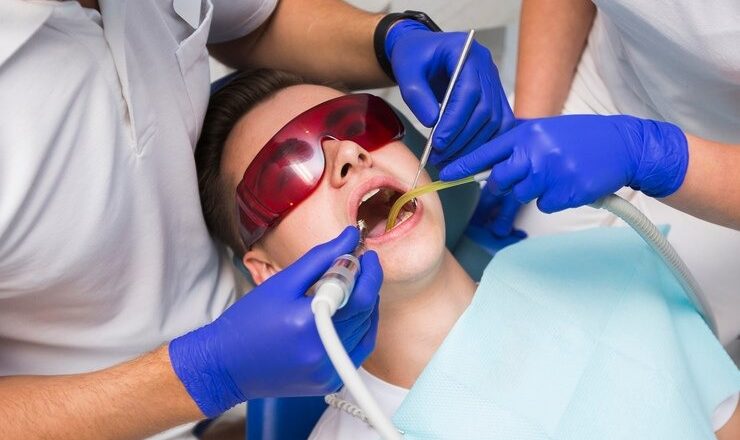 Tout ce que t’as besoin de savoir sur le détartrage dentaire : pour un sourire clean et healthy