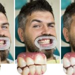 Comment mettre ta dent en avant pour briller